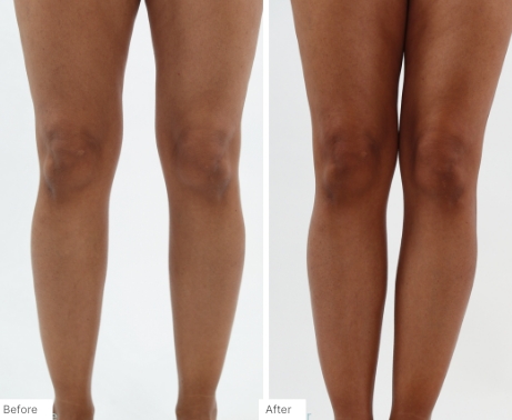 Before and after images of people who have used the 3-in-1 Self Tanning + Sculpting Foam to get natural, streak-free tans